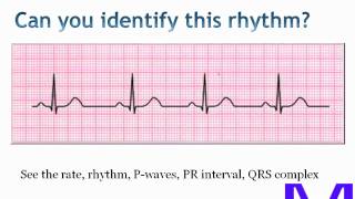 ECGEKG Electrocardiogram interpretation [upl. by Germin]