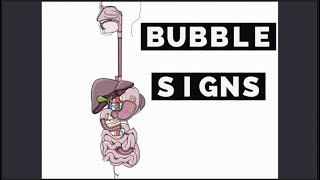 Lets count Bubbles in X ray Bubble signs [upl. by Telford246]