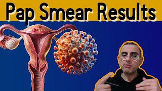 Pap Smear 101  Explained Pap Smear results meaning Pap Test [upl. by Brezin]