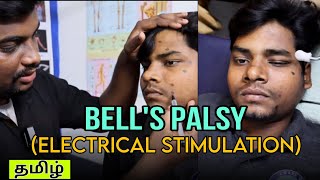 Electrical Stimulation for Bells Palsyதமிழ்Motor points for Bells Palsybellspalsy [upl. by Ayoj]