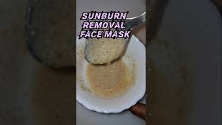 SUNBURN REMOVAL FACE MASK sunburn sunburnremoval facemask faceglowbeauty sunburnt shorts [upl. by Sayres462]