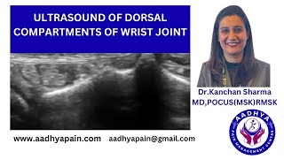 Ultrasound of the dorsal compartments of the wrist joint [upl. by Nyram]