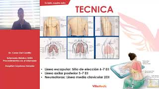 CLASE Nº8  Toracocentesis [upl. by Artined]