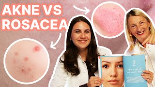 Rosacea vs Akne  Ärztinnen klären auf 🌹 [upl. by Atled840]