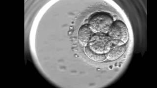 Human embryo growth under microscopic time lapse photography [upl. by Adrea]