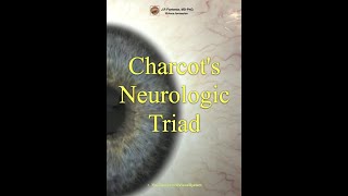 Multiple Sclerosis Charcots Neurologic Triad [upl. by Ibok488]