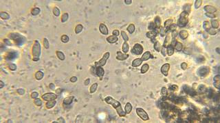 Bacteria and yeast movement microscope video [upl. by Neffets]