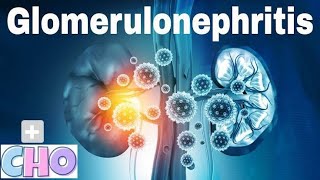 Glomerulonephritis  Kidney  Notes [upl. by Samled]