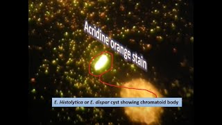 Acidine orange stained slide of chromatoid body of E histolytica or dispar [upl. by Paul]