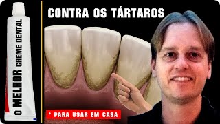 Tártaro No Dente  O MELHOR Creme Dental Contra Tártaro no Dente que Existe Para Usar em CASA [upl. by Rramel]