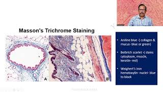 MD DNB Practical CONNECTIVE TISSUE STAINS Massons Trichrome Univ Exam [upl. by Steffy]