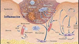 Inflamación Aguda  Fisiopatología [upl. by Curley]