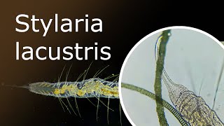 All About Stylaria Lacustris Description and Habitat Stylaria Under a Microscope 100x250x [upl. by Brackely]