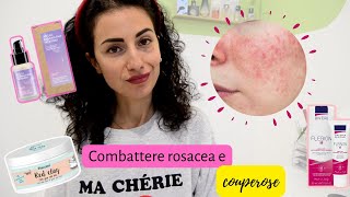 ROSACEA E COUPEROSEQUALI PRODOTTI USARE PER COMBATTERE I ROSSORI [upl. by Ardnoed]