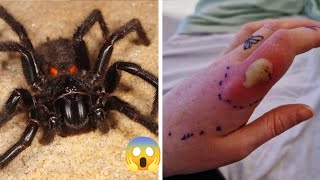 Top 10 MOST Venomous Spiders in the WORLD [upl. by Kai]