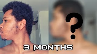 3 Month Beard Growth Time lapse  Surprise Results MINOXIDIL [upl. by Aneen]