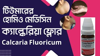 টিউমারের হোমিও ঔষধ ক্যালকেরিয়া ফ্লোর 30 homeopathic medicine calcarea flour 12x 200 [upl. by Braeunig985]