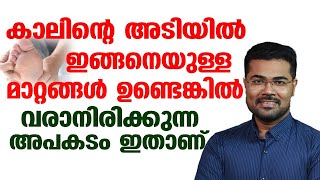 കാലിന്റെ അടിയിൽ ഇങ്ങനെയുള്ള മാറ്റങ്ങൾ മാറ്റങ്ങൾ ഉണ്ടെങ്കിൽ വരാനിരിക്കുന്ന അപകടം ഇതാണ് [upl. by Milah]