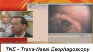 TNE TransNasal Esophagoscope Endoscopy Endoscope GMA [upl. by Robet]