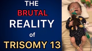 The BRUTAL Reality of Having a Trisomy Child Trisomy 13 amp 18 13トリソミー [upl. by Jonna]