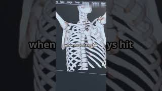 How XRays Works Explained under 60 Seconds [upl. by Fergus950]