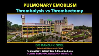 Thrombolysis vs Thrombectomy in Pulm Embolism [upl. by Siravart718]