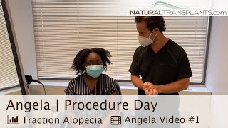 Traction Alopecia Hair Transplant for Female  Dr Kevin Blumenthal Angela [upl. by Aisela]