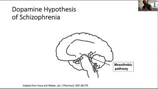 Tardive Dyskinesia Recognition and Treatment [upl. by Tiler]