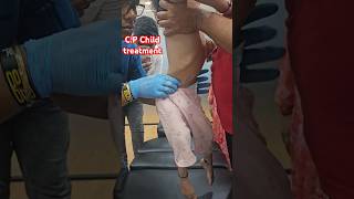 CP Child treatment drrajneeshkant chiropractor worldfamouschiropractor [upl. by Musa]