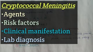 Cryptococcal meningitis  Agents  Risk factors  Clinical manifestation  Lab diagnosis [upl. by Dougald]