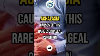 ACHALASIA CAUSES OF THIS RARE ESOPHAGEAL CONDITION shorts achalasia esophagus doctor [upl. by Ainesy331]