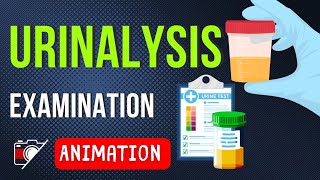 ALL ABOUT URINALYSIS  IN URINARY INFECTION  SAMPLING  INTERPRETATION  Animation [upl. by Africa913]