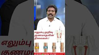 எலும்பு முறிவுக்கு Plate வைப்பது சரியா  Putturkattu Treatment  DrRSவேலுமணி  044  20002000 [upl. by Tab]