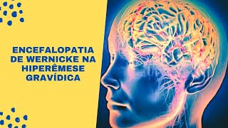 Encefalopatia de Wernicke na Hiperêmese Gravídica Revisão Sistemática [upl. by Itnuahsa]