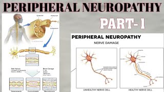 PERIPHERAL NEUROPATHY  PART1  WALLERIAN DISTAL AXONAL DEGENERATION amp SEGMENTAL DEMYELINATION [upl. by Kean]