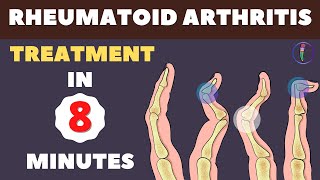 Rheumatoid Arthritis Treatment  New Medicines and Updates [upl. by Zerep482]