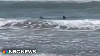 Texas shark attack survivor speaks out [upl. by Uhthna]