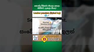 Lumbar puncture Spinal tap💉  Medical biology  අපි නොදන්න Biology  7🫀biology medical shorts [upl. by Vail]