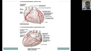 Webinaire quotLes Cardiopathies Ischémiquesquot avec Dr Adlane Rezzoug [upl. by Naida604]