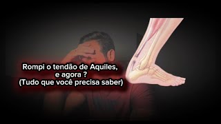 Rompi o tendão de Aquiles o que faço agora  Tire todas suas dúvidas com esse vídeo [upl. by Aekerly992]