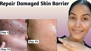 Damage Skin Repair  Only 1 Week Remove Scars Large open PoresAnti ageing wrinkles skincare [upl. by Alysa]