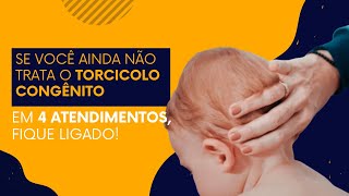 Você ainda não trata o Torcicolo Congênito em 4 atendimentos  Conteúdo para fisioterapeutas [upl. by Claudell528]