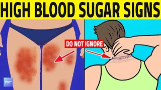 Top 7 Prediabetes Signs You Shouldnt Ignore [upl. by Koby468]