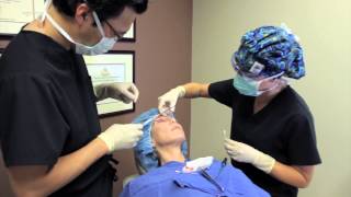 In Office Eyelid Surgery Performed by Virginia Beach surgeon Dr Choe [upl. by Kendre]