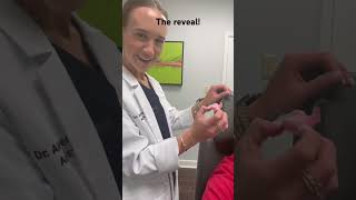 Dr Culberson taking an ear mold impression Part 3 of 3 ears audiology [upl. by Braunstein252]