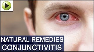 Conjunctivitis Pink Eye  Natural Ayurvedic Home Remedies [upl. by Ratcliffe]