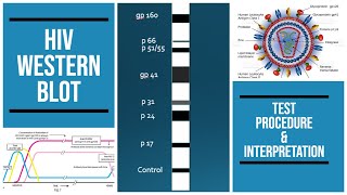 HIV western blot  SDS gel  procedure  Interpretation  pathology pathologylab biochemistry [upl. by Pradeep679]