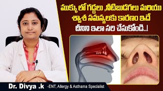 ముక్కులో గడ్డలు  How To Cure Nasal Polyps  Nasal Polyps Symptoms And Treatment  Sankhya Hospital [upl. by Aciras]