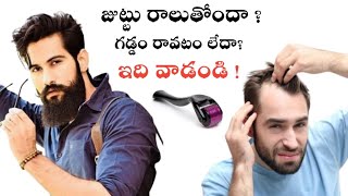 derma roller review in telugu for hair loss and beard growth [upl. by Yenwat38]