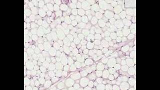 Shotgun Histology Adipose Tissue [upl. by Issi]